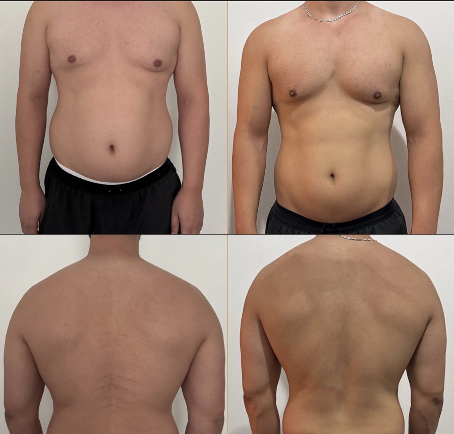Joseph, front and back, before and after over 6 months